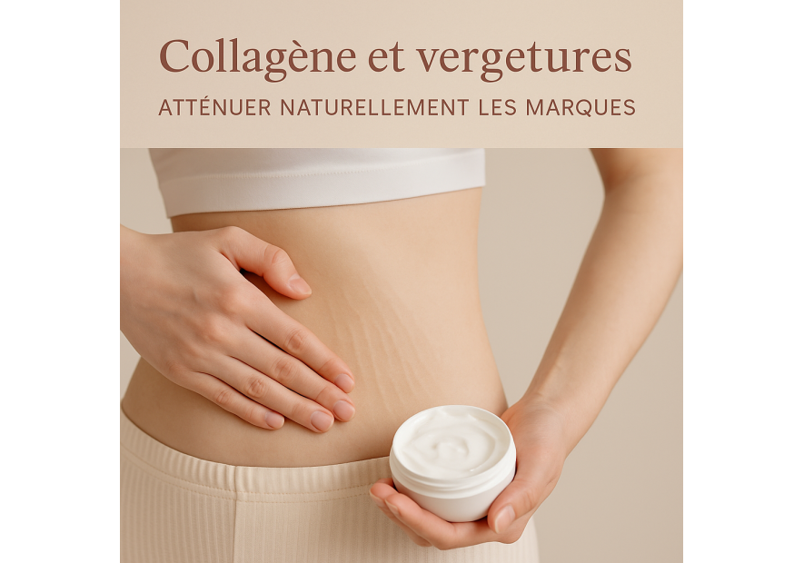 Collagène et vergetures : atténuer naturellement les marques